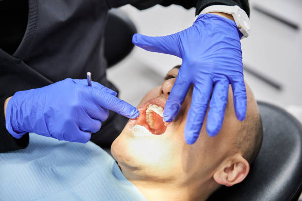 Best Emergency Tooth Extraction in College Station, TX